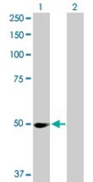 Anti-PPM1F antibody produced in rabbit