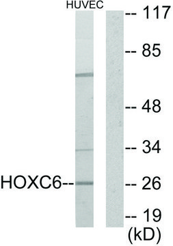 Anti-HOXC6 antibody produced in rabbit