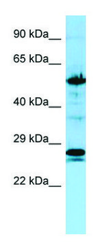 Anti-KRT6A (C-terminal) antibody produced in