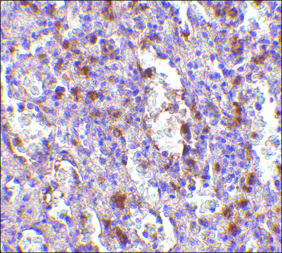 Anti-ORAI1 antibody produced in rabbit