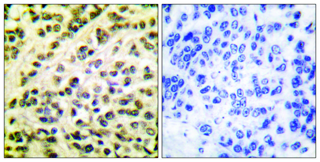 Anti-FLI1 antibody produced in rabbit