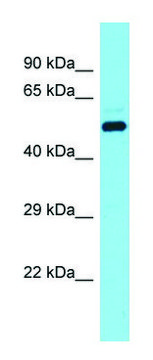Anti-DCAF17 (N-terminal) antibody produced in