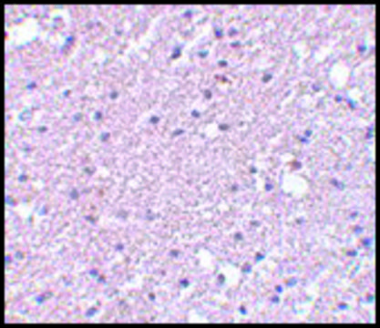 Anti-TMEM184A antibody produced in rabbit