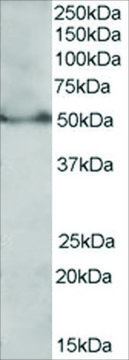 Anti-PPAR ? (Isoform 1) antibody