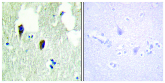 Anti-KLHL3 antibody produced in rabbit