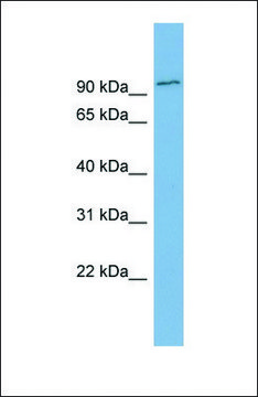 Anti-FBXO34 antibody produced in rabbit