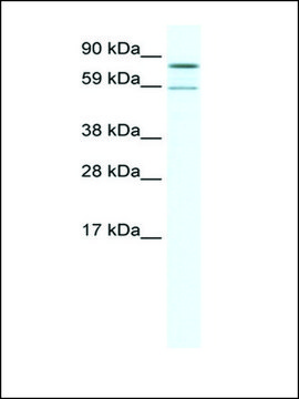 Anti-PARN antibody produced in rabbit
