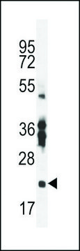 ANTI-RBPMS2 (CENTER) antibody produced in