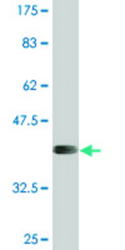 Monoclonal Anti-APOL6, (N-terminal) antibody produced