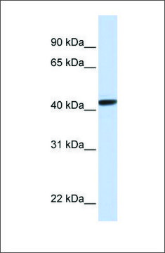 Anti-CLN8 (ab1) antibody produced in