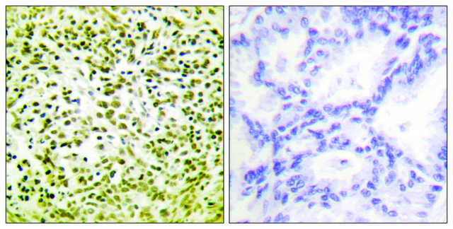 Anti-p53 antibody produced in rabbit