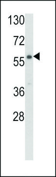 ANTI-CARS2(C-TERMINAL) antibody produced in rabbit