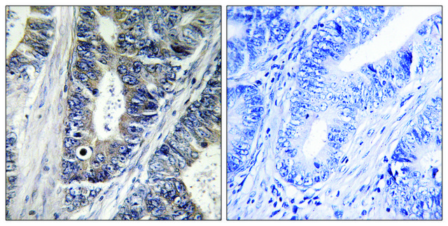 Anti-MAP3K9 antibody produced in rabbit