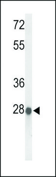 ANTI-ABHDB (CENTER) antibody produced in