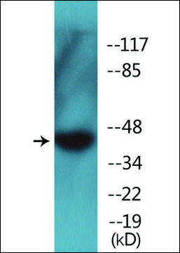Anti-phospho-GIRK1/KIR3.1/KCNJ3 (pSer¹??) antibody produced in