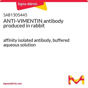 ANTI-VIMENTIN antibody produced in rabbit