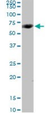 Anti-CYP4V2 antibody produced in rabbit