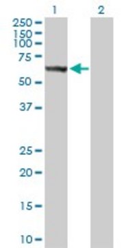 Anti-STK33 antibody produced in rabbit