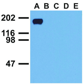 Monoclonal Anti-EGFR (PhosphoTyr992) antibody produced