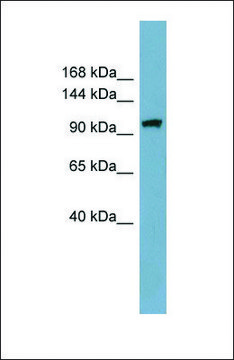 Anti-ELP2 antibody produced in rabbit