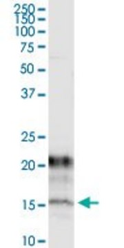 Monoclonal Anti-KCNE1 antibody produced in