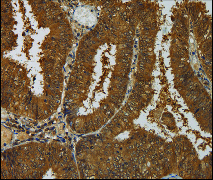 Anti-TAB1 antibody produced in rabbit