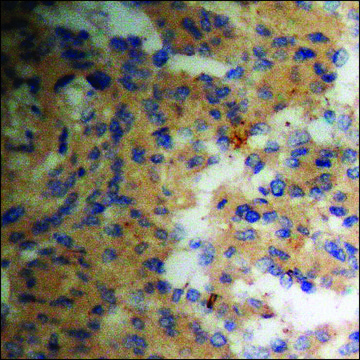 Anti-phospho-Pin1 (pSer¹?) antibody produced in