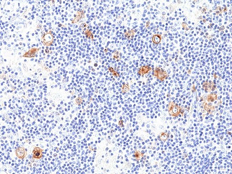 Anti-CD30 Rabbit Monoclonal Antibody