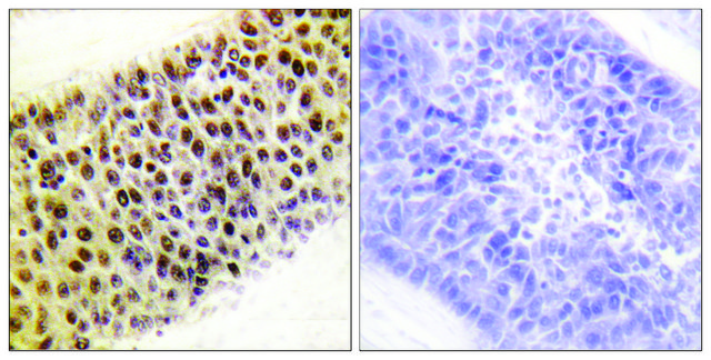 Anti-TIP60 antibody produced in rabbit