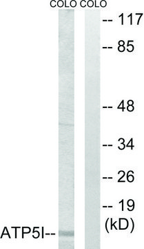 Anti-ATP5I antibody produced in rabbit