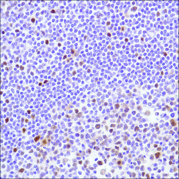Anti-Cyclin D3 antibody, Rabbit monoclonal