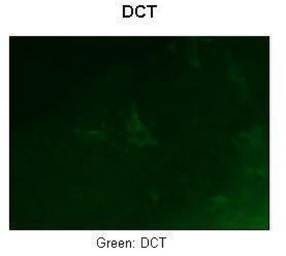 Anti-DCT antibody produced in rabbit
