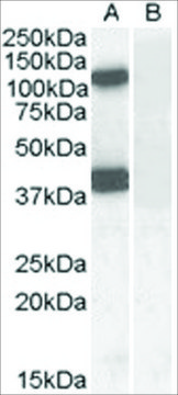 Anti-EPB41L2 /4.1G (AA 593-604) antibody