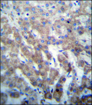 ANTI-FGFRL1 (N-TERM) antibody produced in