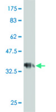 ANTI-GUCY2C antibody produced in mouse