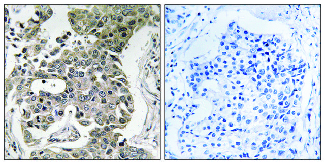 Anti-PPP2R1B antibody produced in rabbit