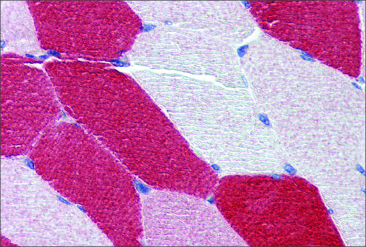Anti-MYL6 (ab2) antibody produced in
