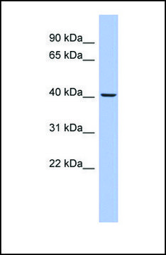 Anti-PRKACB antibody produced in rabbit