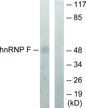 Anti-HNRNP F antibody produced in