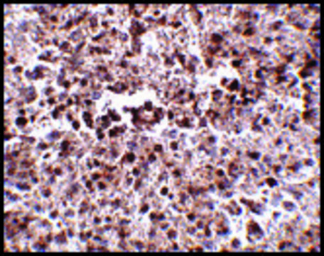 Anti-METTL7B (ab2) antibody produced in