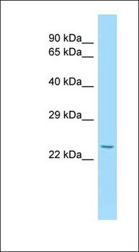 Anti-IL15RA antibody produced in rabbit