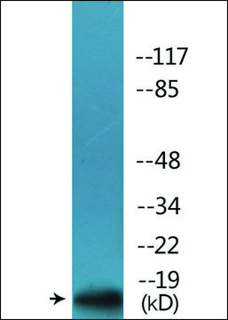 Anti-phospho-p16-INK4a (pSer¹?²) antibody produced in