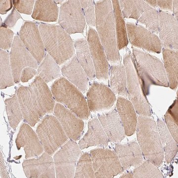 Anti-EMC10 antibody produced in rabbit