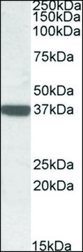 Anti-CNN3 (C-terminal) antibody produced in