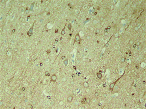 Anti-phospho-MAPT (pSer³??) antibody produced in