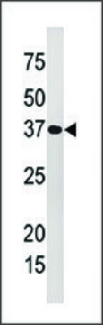 Anti-PHF22 (N-term T88) antibody produced