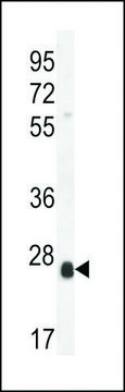 ANTI-SCXA(C-TERMINAL) antibody produced in rabbit