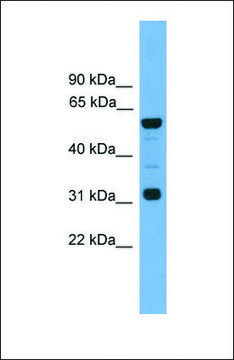 Anti-GJA10, (N-terminal) antibody produced in