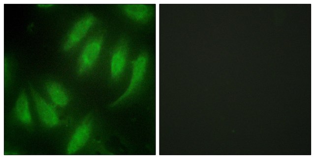 Anti-HEXIM1 antibody produced in rabbit