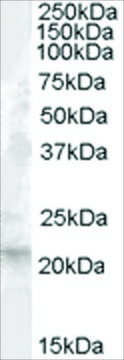 Anti-Fibroblast Growth Factor 21 antibody